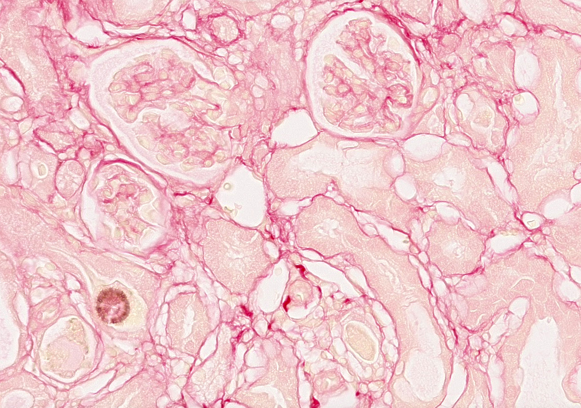 Sirius red-stained kidney section from adenine-induced nephropathy