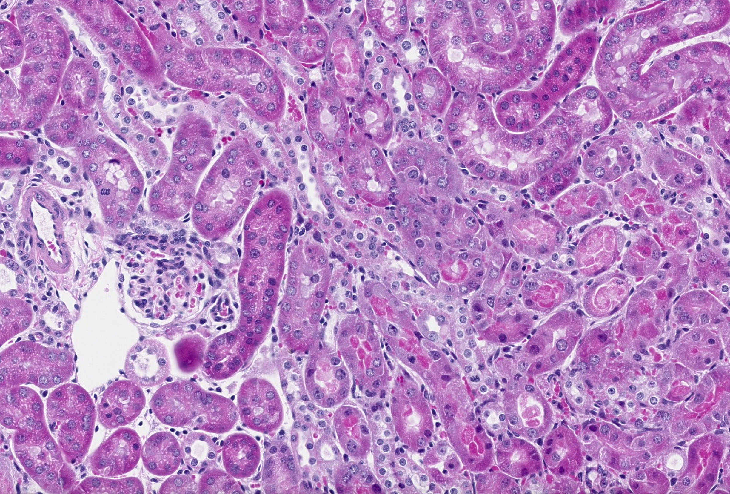 PAS-stained kidney section after ischemia-reperfusion injury
